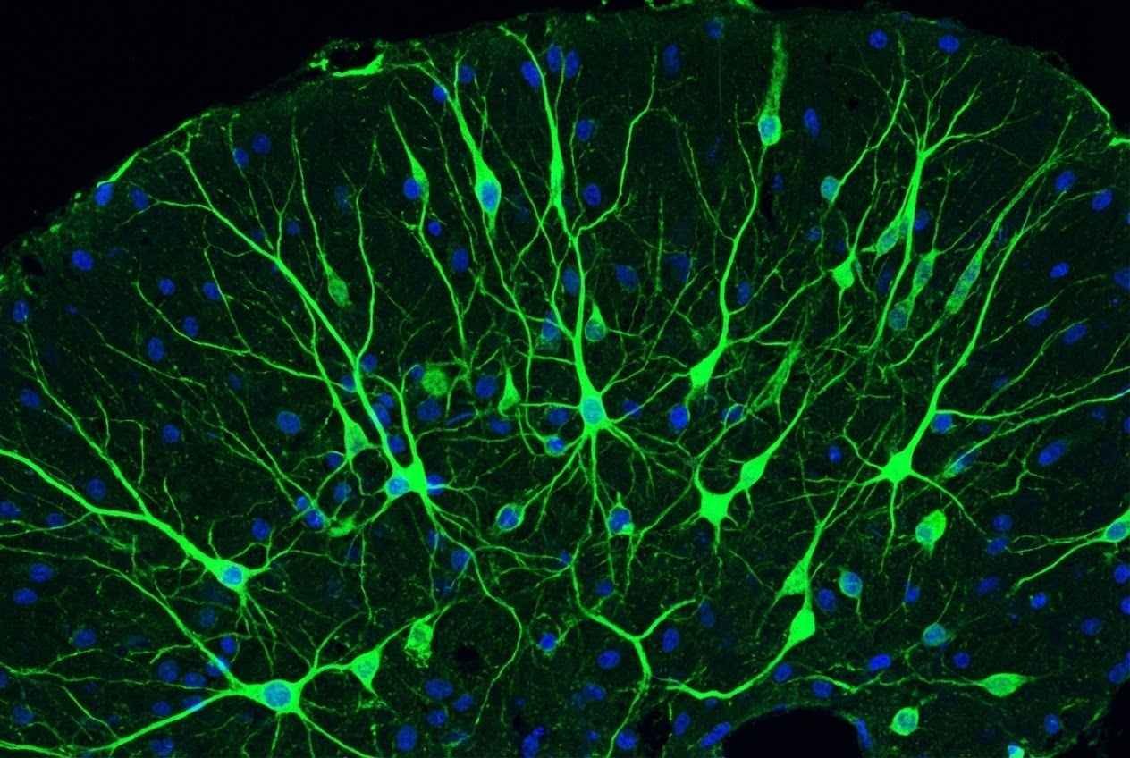 Anti-Rat Calretinin Polyclonal Antibody: A Guide to Neurotransmitter Detection and Neurological Research Applications